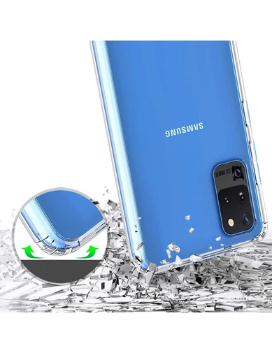 Needion - Teleplus Samsung Galaxy S20 Plus Kılıf Magic Kristal Sert Silikon 